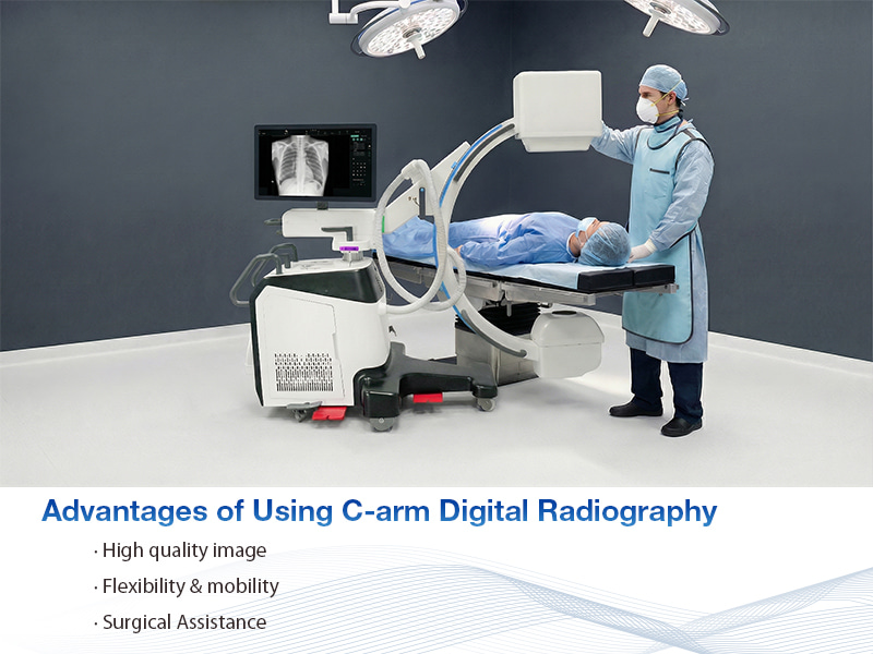 advantages of using C-arm digital radiography ventajas de utilizar la radiografía digital con arco en C