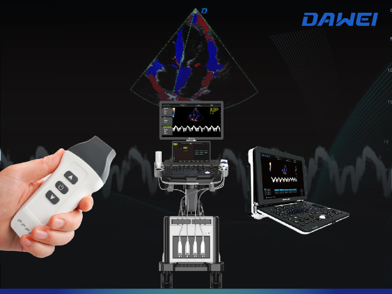 Breakthrough in Motion and Blood Flow Imaging Avance en imágenes de movimiento y flujo sanguíneo