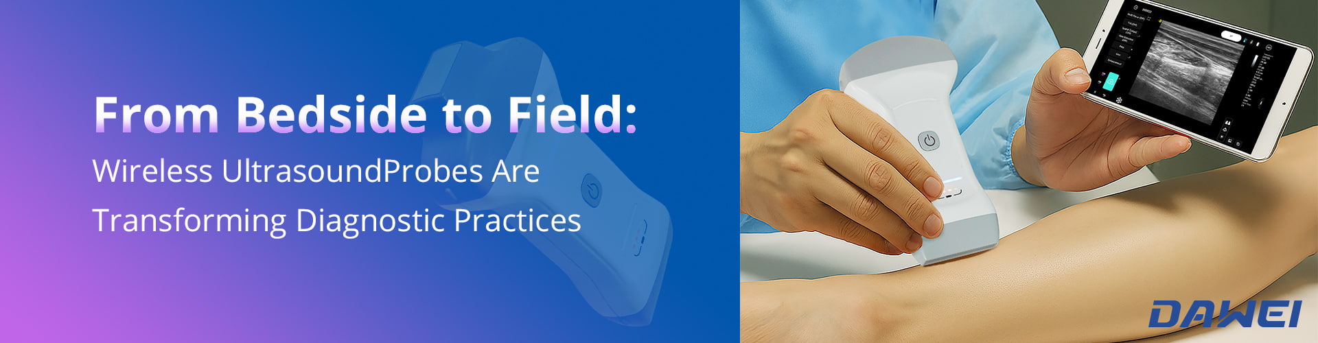 From Bedside To Field How Wireless Ultrasound Probes Are Transforming Diagnostic Practices De la cabecera al campo Cómo las sondas de ultrasonido inalámbricas están transformando las prácticas de diagnóstico