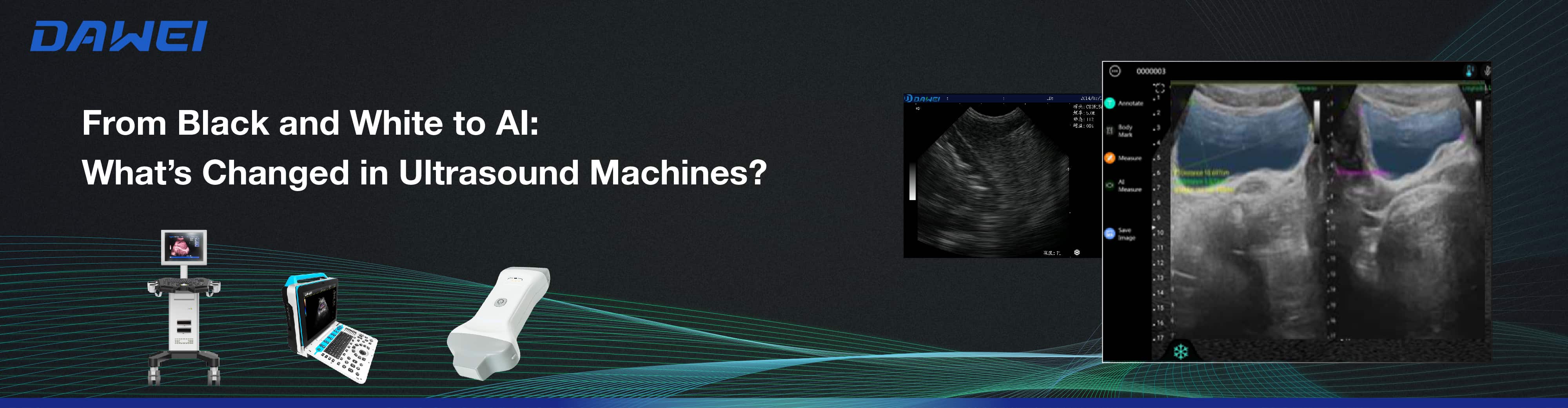 From Black and White to AI What’s Changed in Ultrasound Machines Del blanco y negro a la IA: lo que ha cambiado en las máquinas de ultrasonido