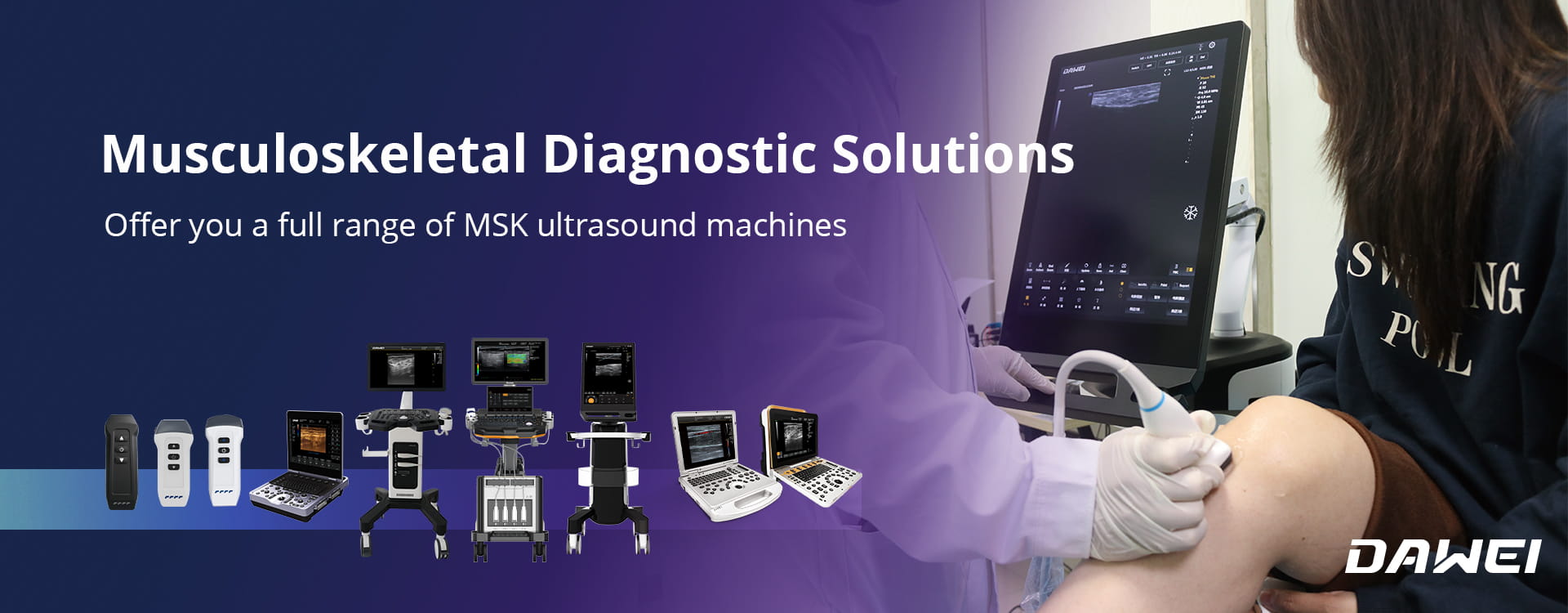 Ultrasonido MSK de Dawei Medicals: soluciones integrales de diagnóstico musculoesquelético de alto rendimiento