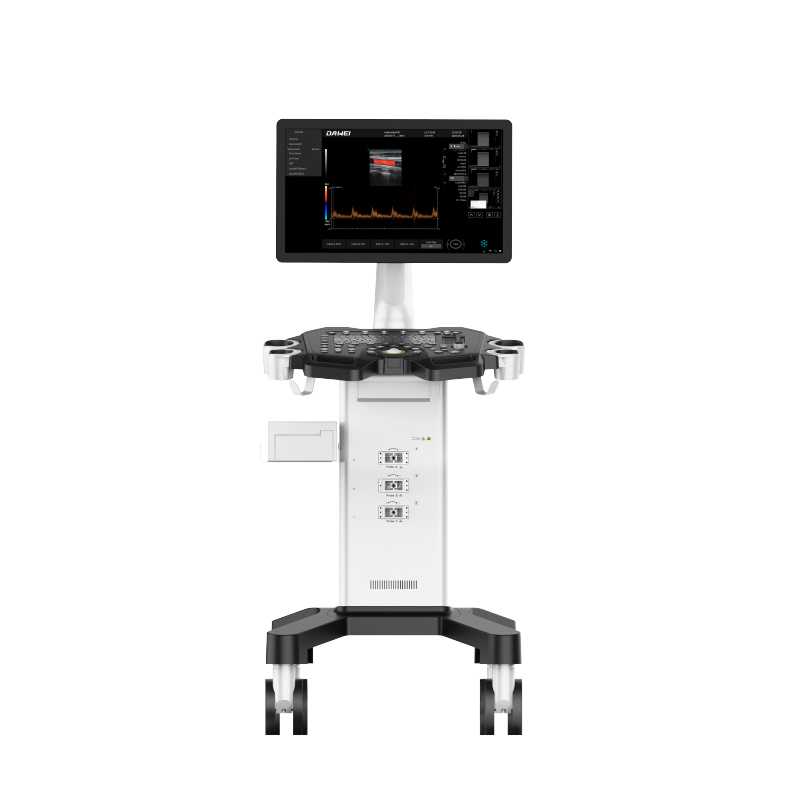 Equipo de ultrasonido Doppler de color de carrito barato