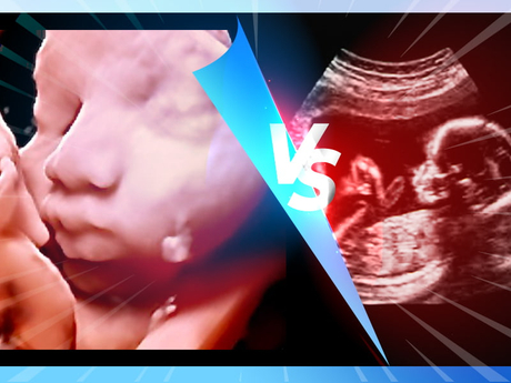 How Do 3D Ultrasound Machines Compare to Traditional 2D Ones.jpg