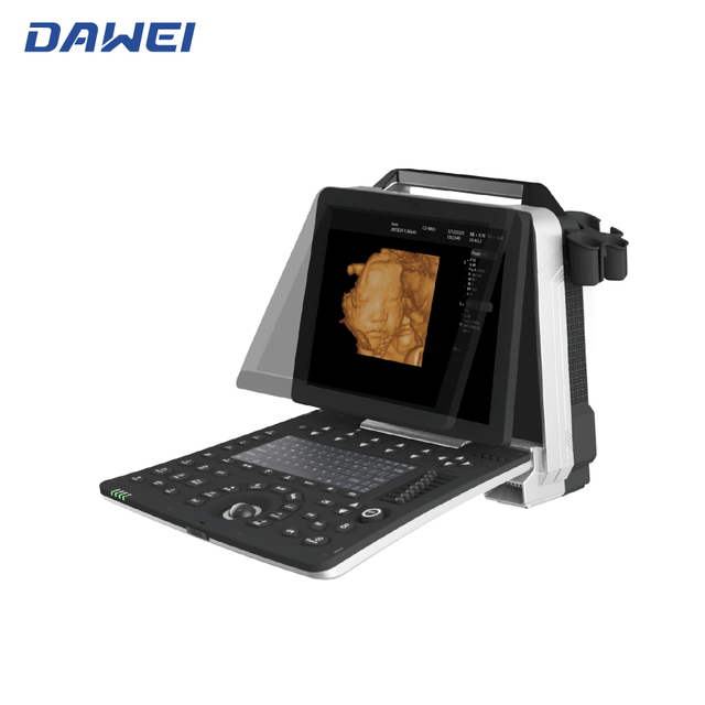 Máquina de ultrasonido 3D 4D portátil barata