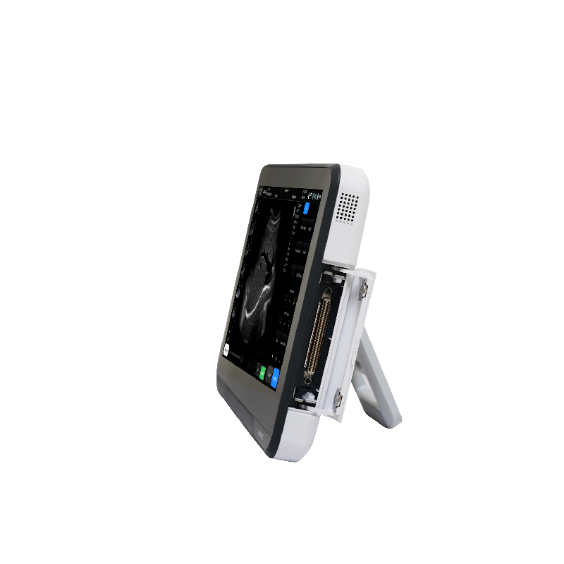 M&aacute;quina de ultrasonido port&aacute;til con pantalla t&aacute;ctil