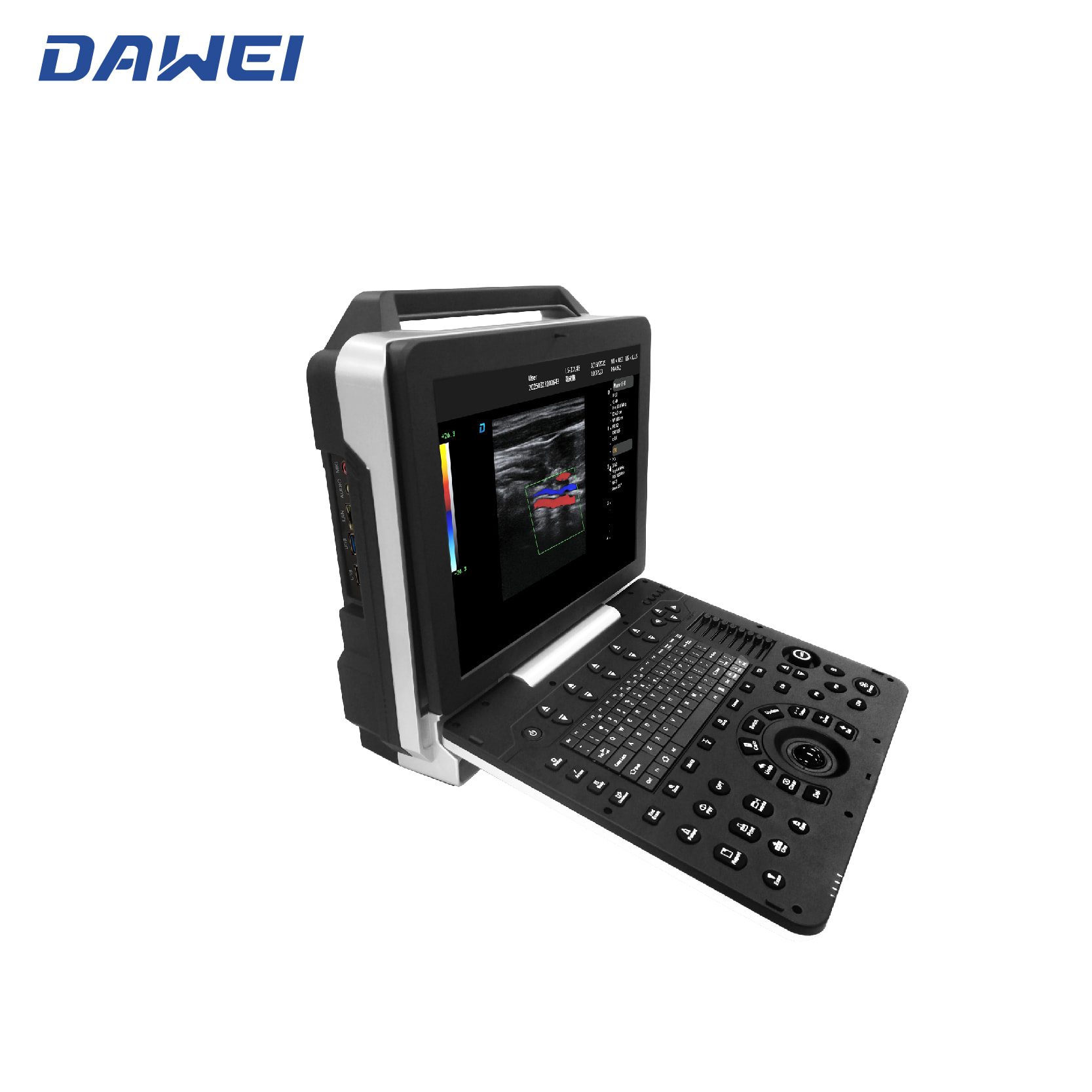 Máquina de ultrasonido 3D 4D portátil barata