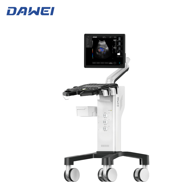 Equipo de ultrasonido Doppler de color de carrito barato