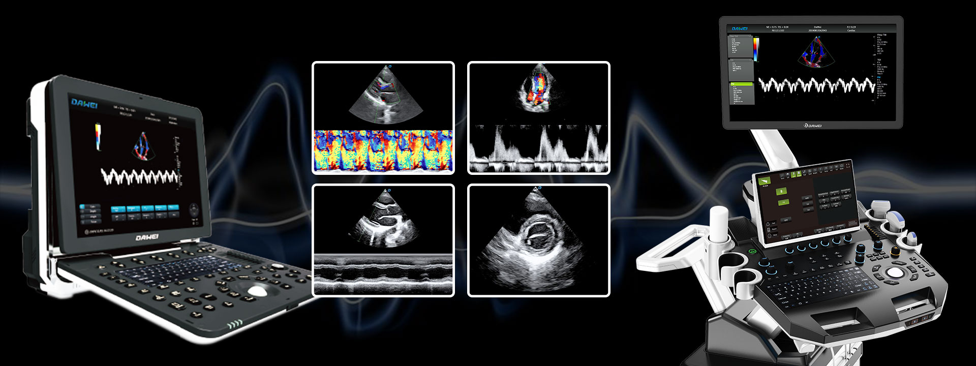 Elegir la máquina de ultrasonido de cardiología adecuada: características, beneficios y consideraciones clave-1920-720