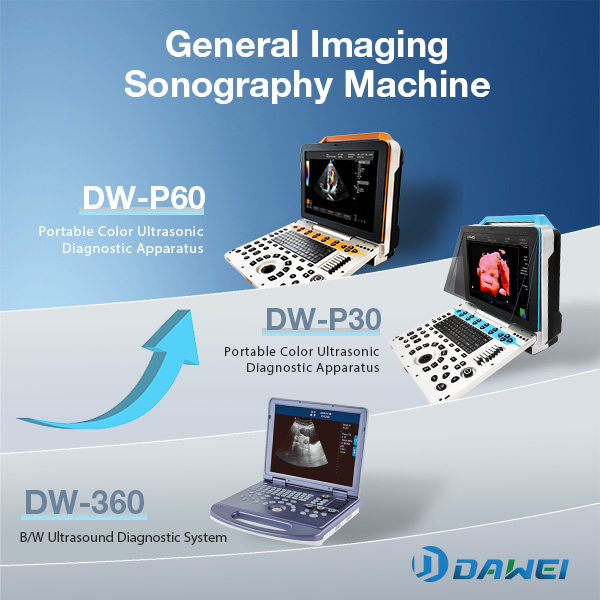 finding the high cost-effective general imaging sonography machine-600-600.jpg