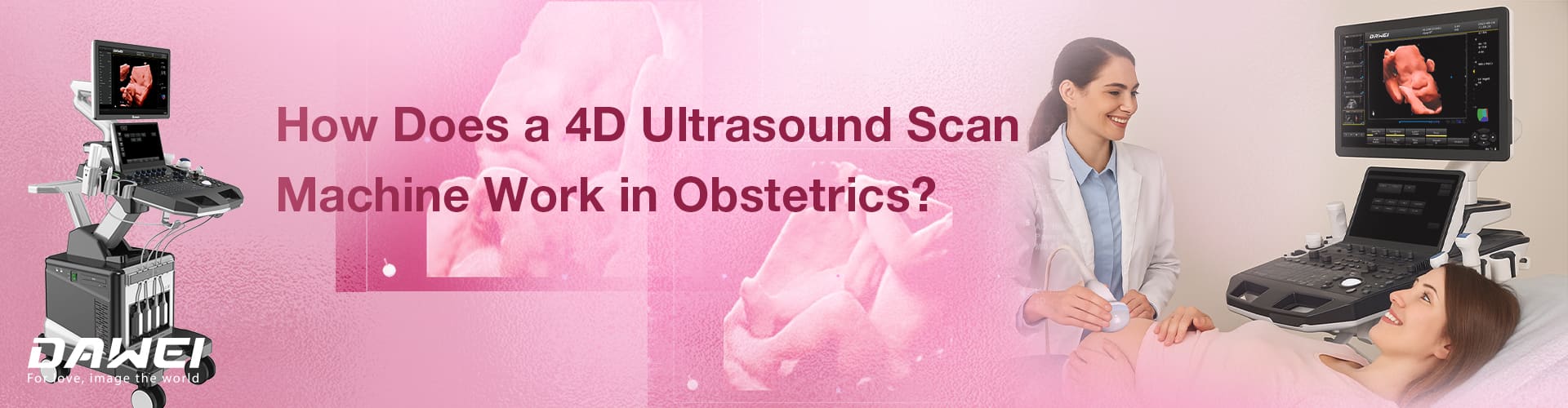 ¿Cómo funciona una máquina de escaneo de ultrasonido 4D en obstetricia?
