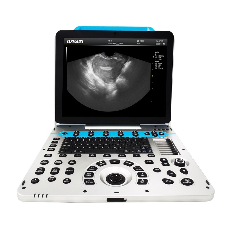 Máquina de ultrasonido en color OB&GYN 4D