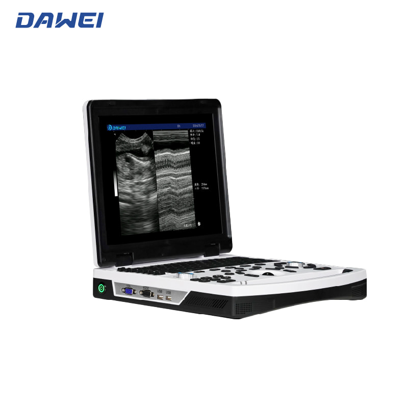 Sistema de diagn&oacute;stico ultras&oacute;nico port&aacute;til B/W