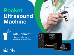 5.23 best handheld ultrasound machine800 600.jpg