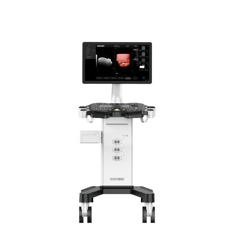 Equipo de ultrasonido Doppler de color de carrito barato