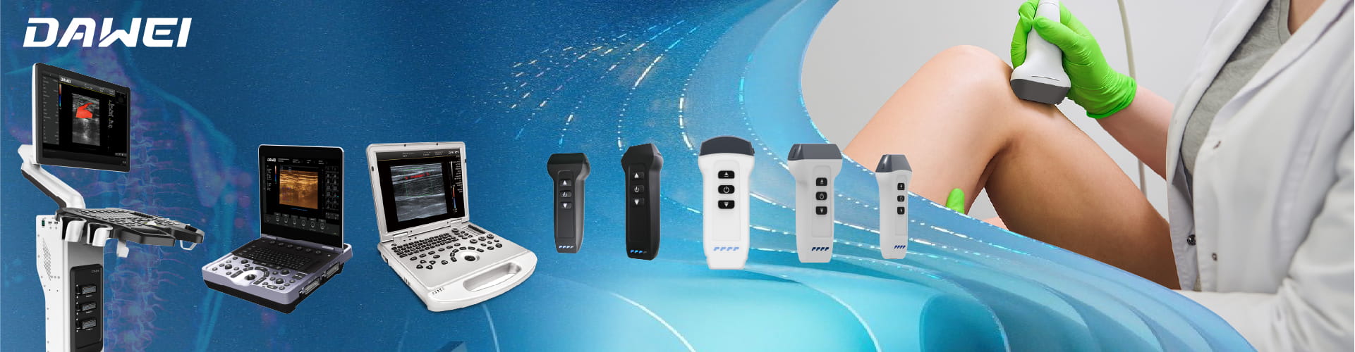 Máquinas de ultrasonido MSK que permiten un diagnóstico de MSK más rápido y seguro
