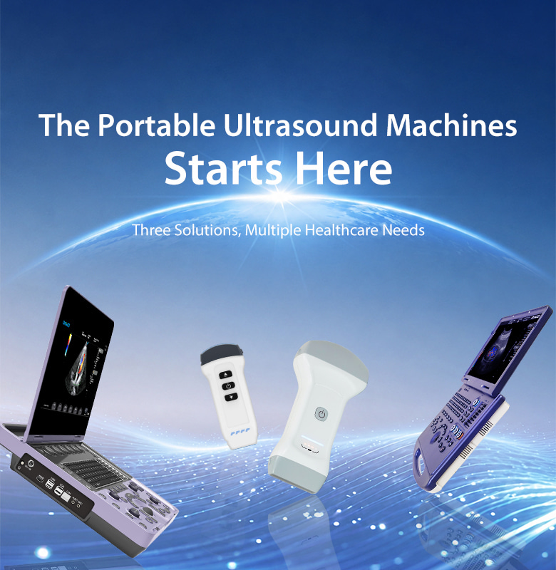 the portable ultrasound machines starts Dawei Medical