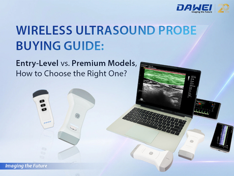 Wireless Ultrasound Probe Buying Guide.jpg
